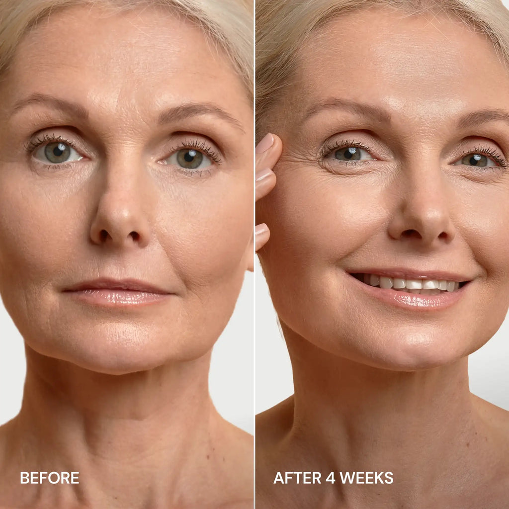 24K Gold V-Line Lifting Mask